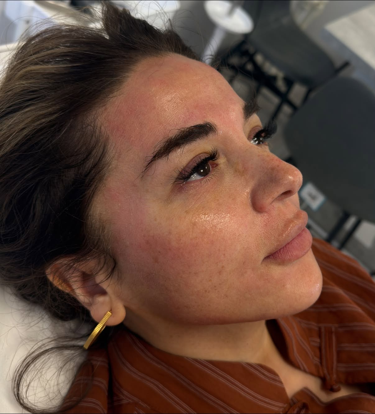 Genuine Simply Skin client showing healthy-looking skin after treatment